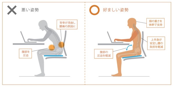 前傾姿勢の特徴（出典：「The Posture　はたらく姿勢を考える」（岡村製作所、2015年）P38 (※）